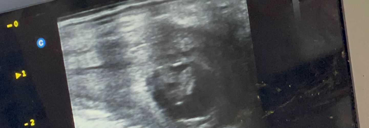 ULTRASONOGRAFÍA REPRODUCTIVA EN BOVINOS