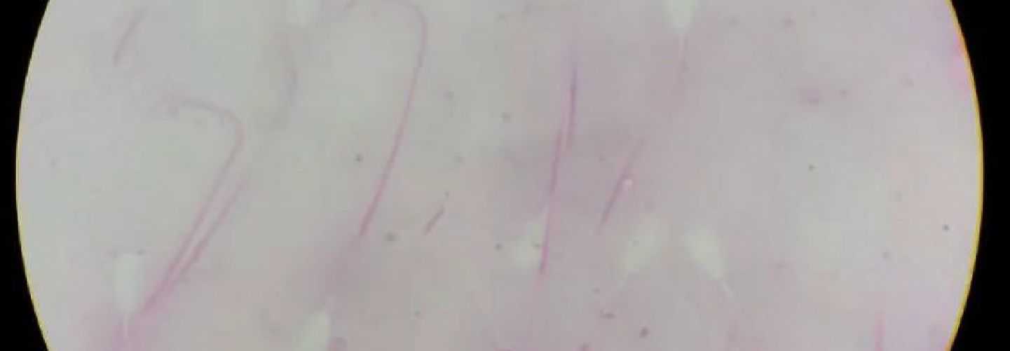 CONGELADO DE SEMEN BOVINO
